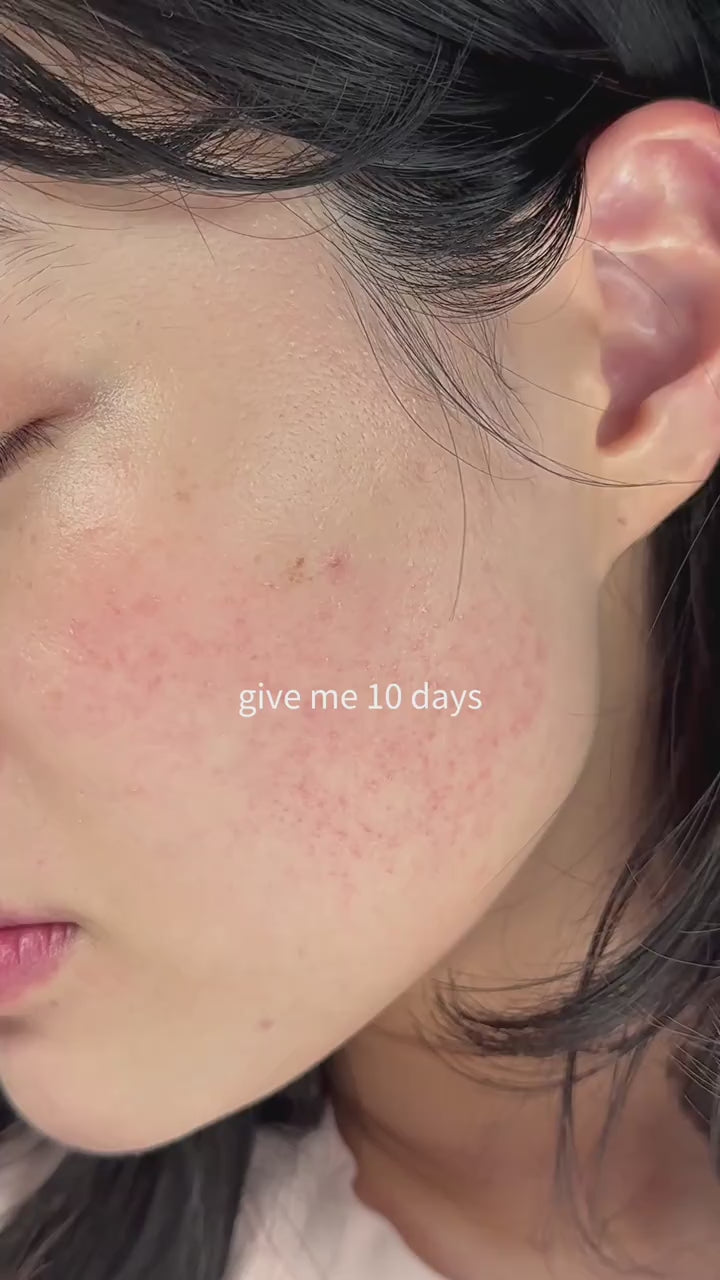 BREYLEE Serum Face Mask