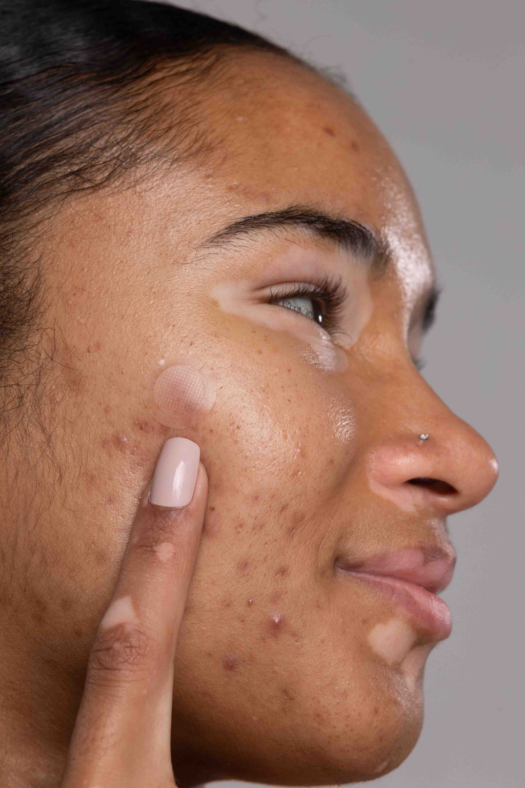 SADOER Salicylic Pimple Patch