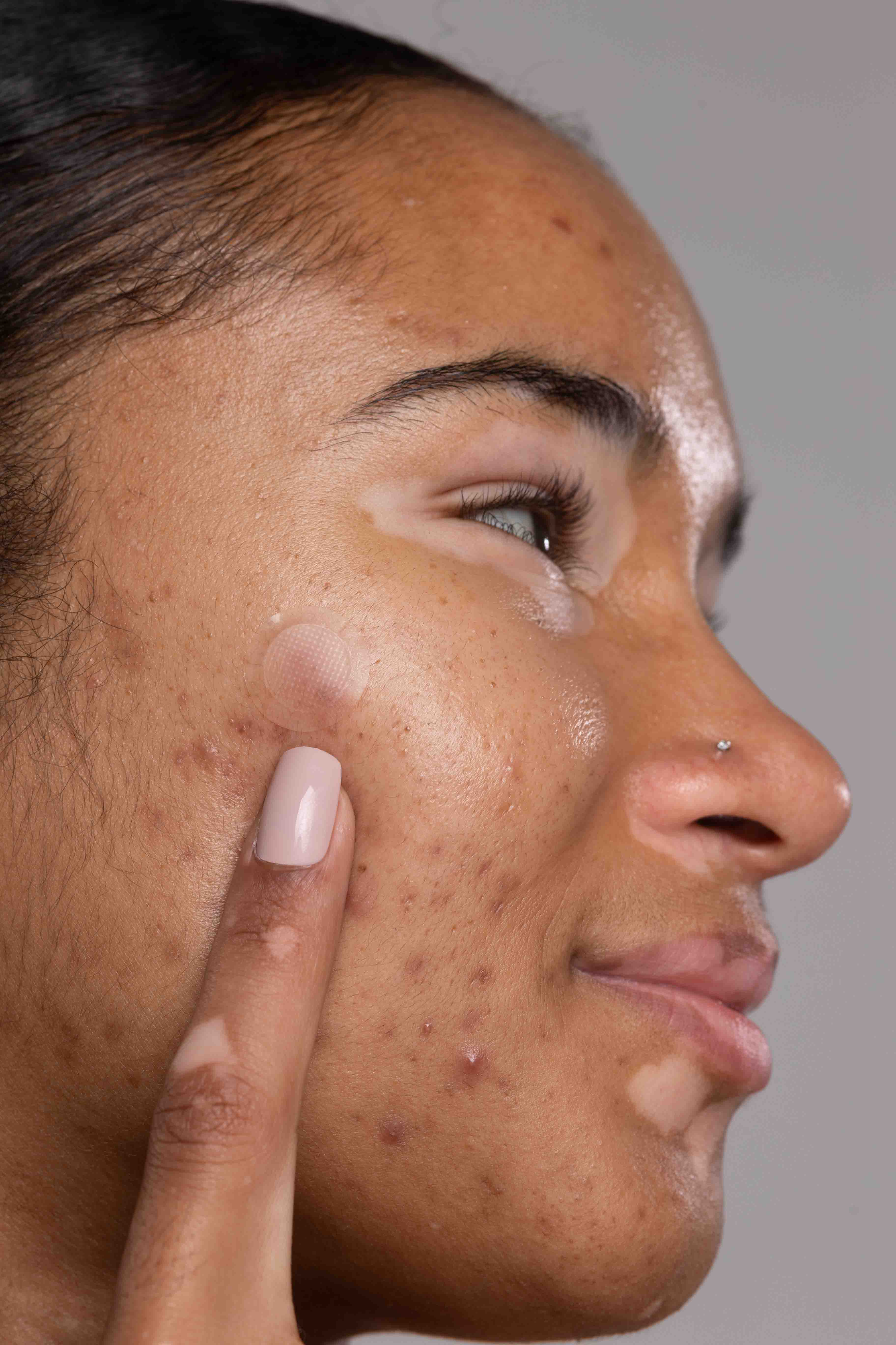 SADOER Salicylic Pimple Patch